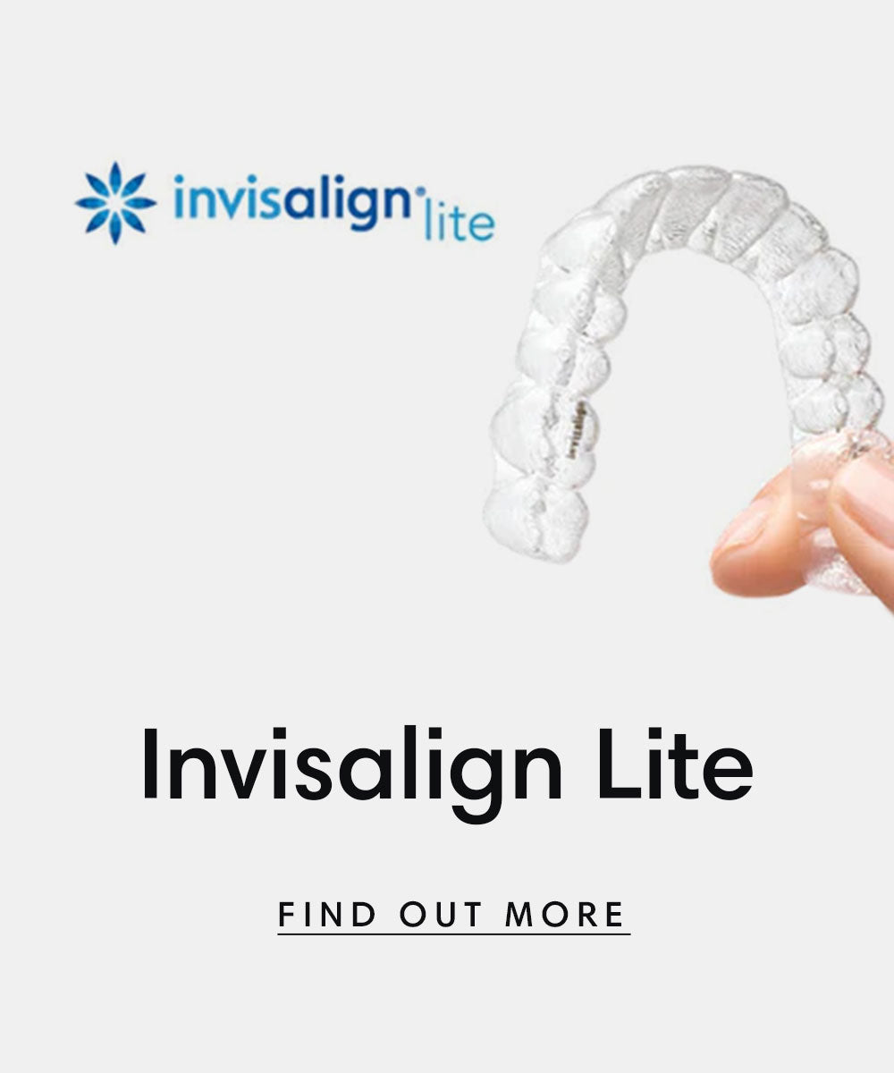 Invisalign lite clear aligner